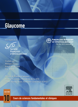 Glaucome Glaucome