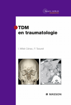 TDM en traumatologie TDM en traumatologie