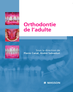 Orthodontie de l’adulte