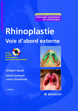 Rhinoplastie. Voie d'abord externe Rhinoplastie. Voie d'abord externe