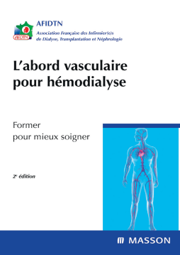 L'abord vasculaire pour hémodialyse L'abord vasculaire pour hémodialyse