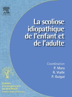 La scoliose idiopathique de l'enfant et de l'adulte La scoliose idiopathique de l'enfant et de l'adulte