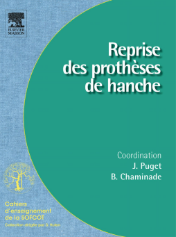 Reprise des prothèses de hanche Reprise des prothèses de hanche