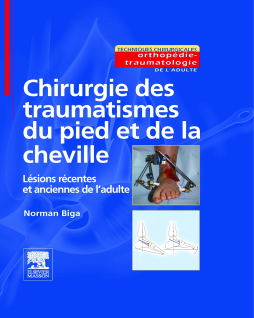 Chirurgie des traumatismes du pied et de la cheville Chirurgie des traumatismes du pied et de la cheville