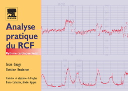 Analyse pratique du RCF Analyse pratique du RCF