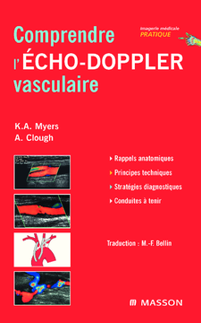 Comprendre l'Echo-Doppler vasculaire
