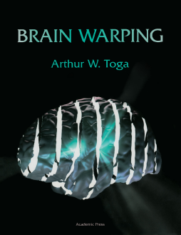Brain Warping Brain Warping