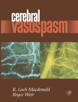 Cerebral Vasospasm Cerebral Vasospasm