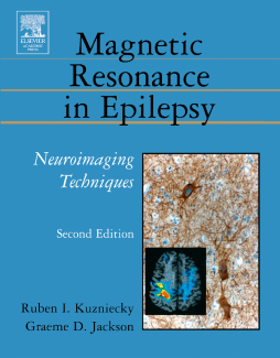 Magnetic Resonance in Epilepsy Magnetic Resonance in Epilepsy