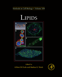 Lipids Lipids