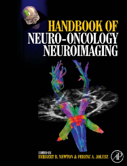 Handbook of Neuro-Oncology Neuroimaging Handbook of Neuro-Oncology Neuroimaging