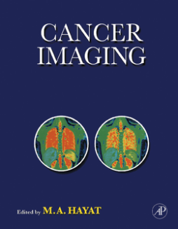 Cancer Imaging Cancer Imaging