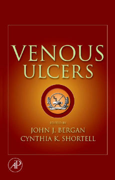 Venous Ulcers Venous Ulcers