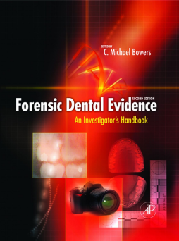 Forensic Dental Evidence Forensic Dental Evidence
