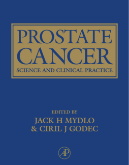 Prostate Cancer Prostate Cancer