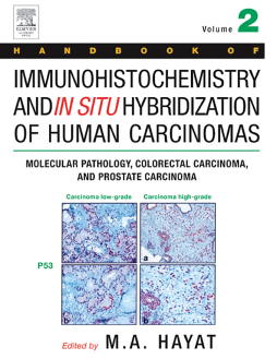 Handbook of Immunohistochemistry and in Situ Hybridization of Human Carcinomas Handbook of Immunohistochemistry and in Situ Hybridization of Human Carcinomas
