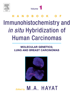 Handbook of Immunohistochemistry and in Situ Hybridization of Human Carcinomas Handbook of Immunohistochemistry and in Situ Hybridization of Human Carcinomas