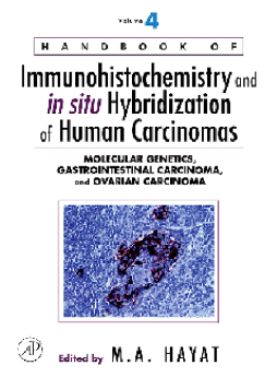 Handbook of Immunohistochemistry and in situ Hybridization of Human Carcinomas Handbook of Immunohistochemistry and in situ Hybridization of Human Carcinomas