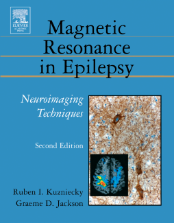 Brain Plasticity and Epilepsy: A Tribute to Frank Morrell