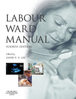 Labour Ward Manual E-Book Labour Ward Manual E-Book