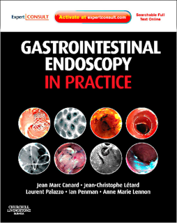 Gastrointestinal Endoscopy in Practice E-Book Gastrointestinal Endoscopy in Practice E-Book