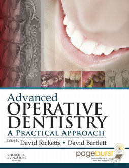 Advanced Operative Dentistry E-Book Advanced Operative Dentistry E-Book