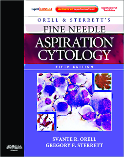 SD - Orell and Sterrett's Fine Needle Aspiration Cytology E-Book SD - Orell and Sterrett's Fine Needle Aspiration Cytology E-Book