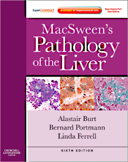SD - MacSween's Pathology of the Liver E-Book SD - MacSween's Pathology of the Liver E-Book