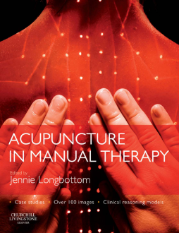 Acupuncture in Manual Therapy -E-Book