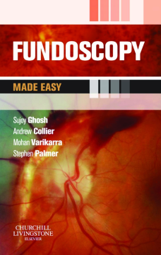 Fundoscopy Made Easy E-Book Fundoscopy Made Easy E-Book
