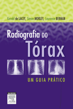 Radiografia Do Tórax Um Guia Prático Radiografia Do Tórax Um Guia Prático