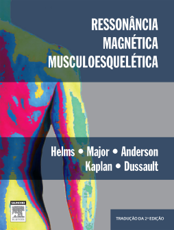 Ressonância Magnética Musculoesquelética Ressonância Magnética Musculoesquelética