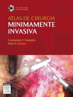 Atlas De Cirurgia Minimamente Invasiva