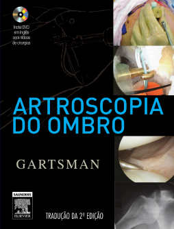 Artroscopia Do Ombro