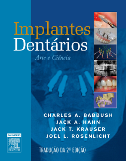 Implantes Dentários Implantes Dentários