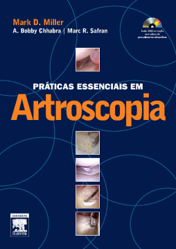 Práticas Essenciais Em Artroscopia Práticas Essenciais Em Artroscopia