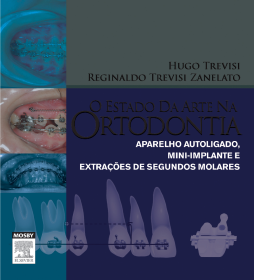 O Estado Da Arte Na Ortodontia O Estado Da Arte Na Ortodontia