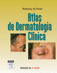 Atlas de Dermatologia Clínica