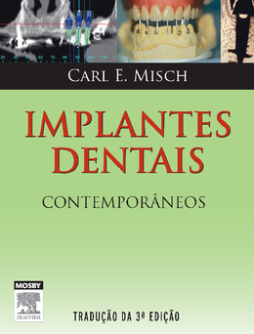 Implantes Dentais Contemporâneos Implantes Dentais Contemporâneos