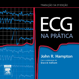 ECG na prática ECG na prática