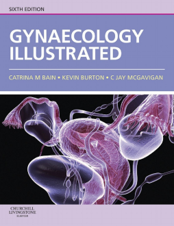 Gynaecology Illustrated E-Book Gynaecology Illustrated E-Book