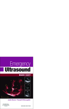 Emergency Ultrasound Made Easy E-Book Emergency Ultrasound Made Easy E-Book