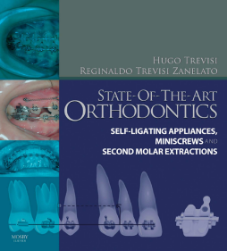 SD - State-of-the-Art Orthodontics E-Book SD - State-of-the-Art Orthodontics E-Book