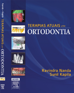 Terapias Atuais em Ortodontia Terapias Atuais em Ortodontia
