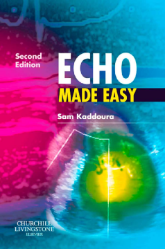 Echo Made Easy E-Book Echo Made Easy E-Book
