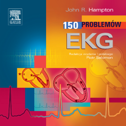 150 Problemów EKG 150 Problemów EKG