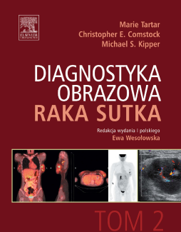 Diagnostyka obrazowa raka sutka. Tom 2 Diagnostyka obrazowa raka sutka. Tom 2
