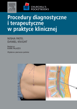 Procedury diagnostyczne i terapeutyczne w praktyce klinicznej. Seria Churchill's Pocketbooks Procedury diagnostyczne i terapeutyczne w praktyce klinicznej. Seria Churchill's Pocketbooks