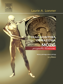 Mózg. Seria Diagnostyka Obrazowa Przypadki kliniczne Mózg. Seria Diagnostyka Obrazowa Przypadki kliniczne