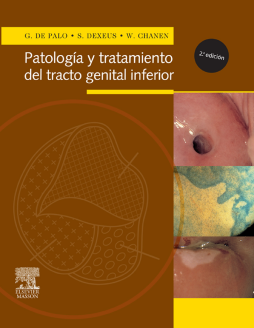 Patología y tratamiento del tracto genital inferior Patología y tratamiento del tracto genital inferior